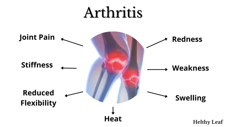 arthritis & Health
