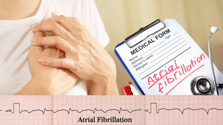 Atrial Fibrillation Treatment